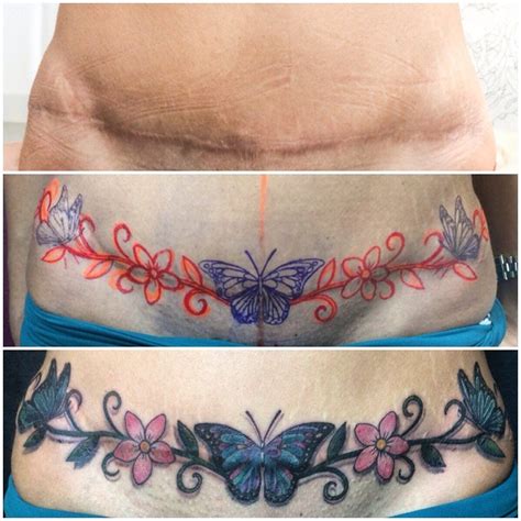 tummy tuck scar tattoos|Beautiful Tummy Tuck Tattoo Designs and Ideas